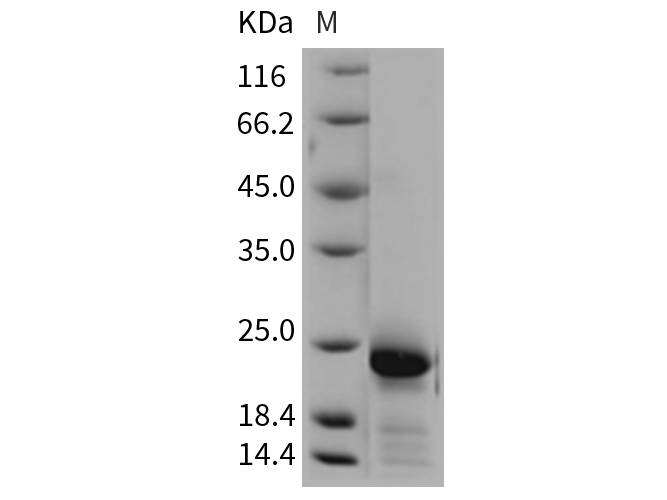 Recombinant Rat IL-6/Interleukin-6 Protein (Active)