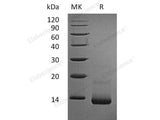 Recombinant Rat CCL5/RANTES Protein (His Tag)