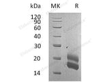 Recombinant Rat GM-CSF/CSF2 Protein (His Tag)
