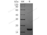 Recombinant Rat SCF/c-Kit Ligand Protein (E.coli, His Tag)