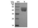 Recombinant Rat CD80/B7-1 Protein (His Tag)