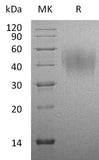 Recombinant Rat CD86/B7-2 Protein (His Tag)