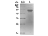 Recombinant 2019-nCoV Spike Protein (RBD, mFc Tag) Store at < -20°C