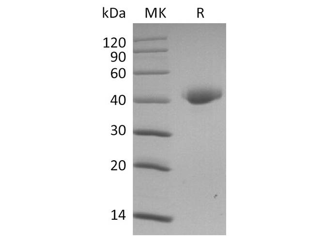 Recombinant 2019-nCoV Spike Protein, Biotinylated (RBD-SD1, Avi-His Tag)