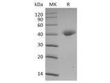 Recombinant 2019-nCoV Spike Protein, Biotinylated (RBD-SD1, Avi-His Tag)