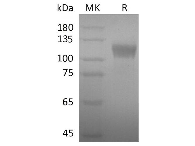 Recombinant 2019-nCoV S1 Protein(Active)