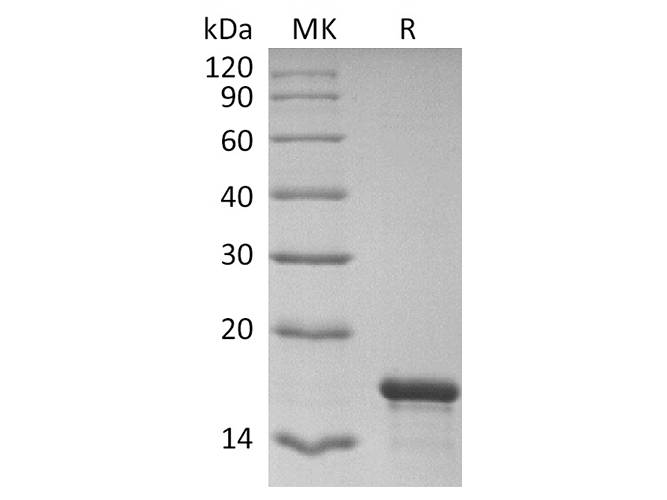Recombinant 2019-nCoV NP NTD domain (His Tag)