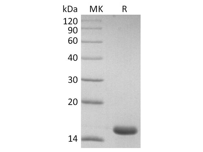 Recombinant 2019-nCoV NP CTD domain Protein