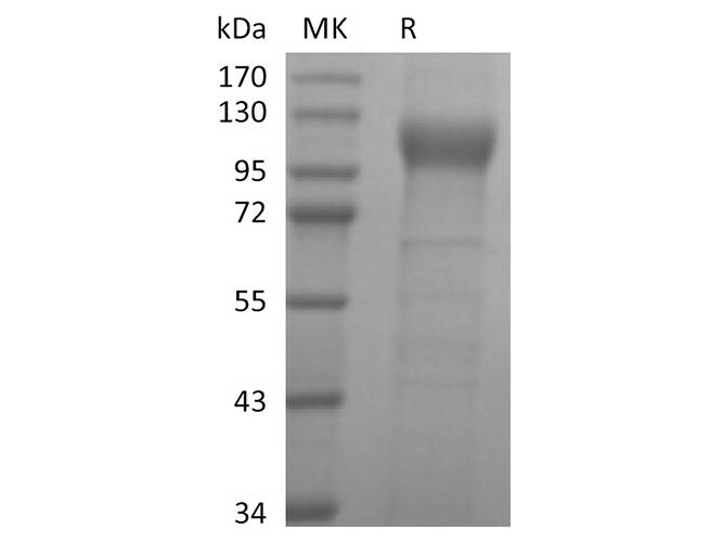 Recombinant Human ACE2 Protein (Avi-His Tag)