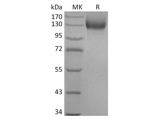 Recombinant Human ACE2 Protein (mFc Tag) Store at < -20°C