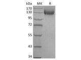 Recombinant Human ACE2 Protein (mFc Tag) Store at < -20°C