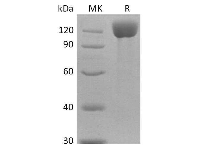 Recombinant Human APN Protein (His Tag)
