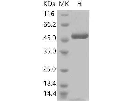 Recombinant 2019-nCoV Nucleocapsid Protein (His Tag)