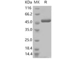 Recombinant 2019-nCoV Nucleocapsid Protein (His Tag)