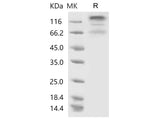 Recombinant 2019-nCoV S1+S2 Protein (ECD, His Tag)