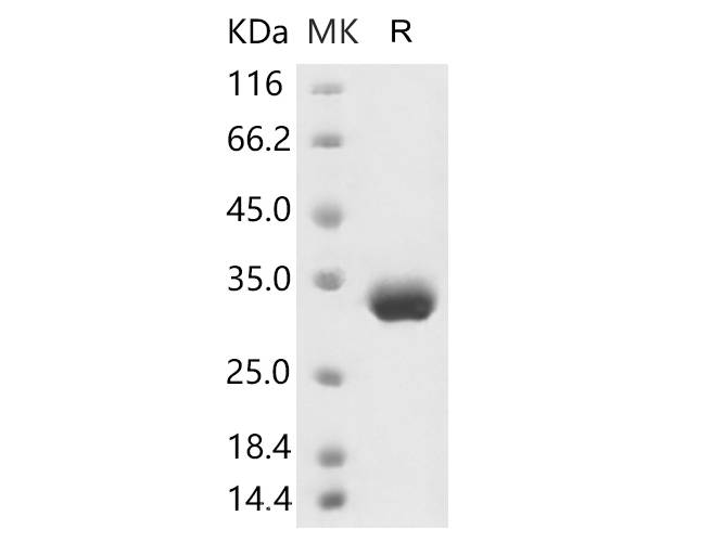 Recombinant 2019-nCoV Spike Protein (RBD, His Tag)  stored at 4-8℃