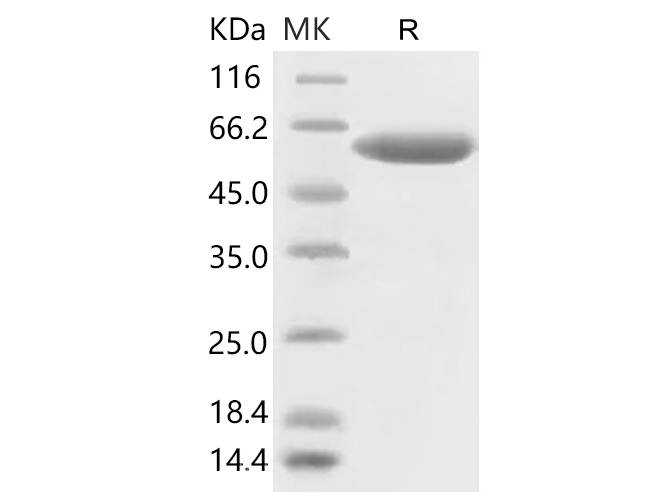 Recombinant 2019-nCoV Spike Protein (RBD, mFc Tag)