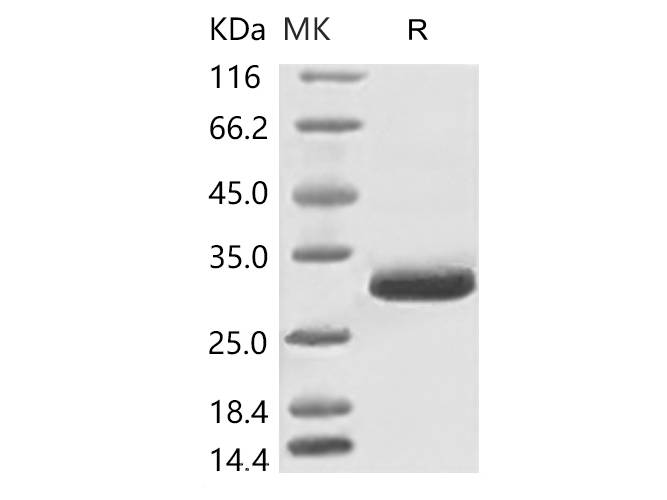 Recombinant 2019-nCoV Spike Protein, Biotinylated (RBD, His Tag) stored at 4-8℃