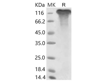 Recombinant 2019-nCoV S1 Protein (Fc Tag)