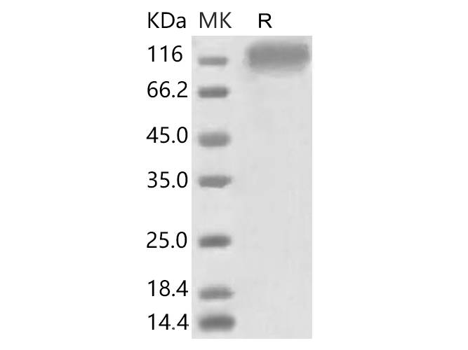 Recombinant 2019-nCoV S1 Protein (His Tag) stored at 4-8℃