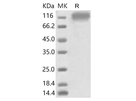 Recombinant 2019-nCoV S1 Protein (His Tag) stored at 4-8℃