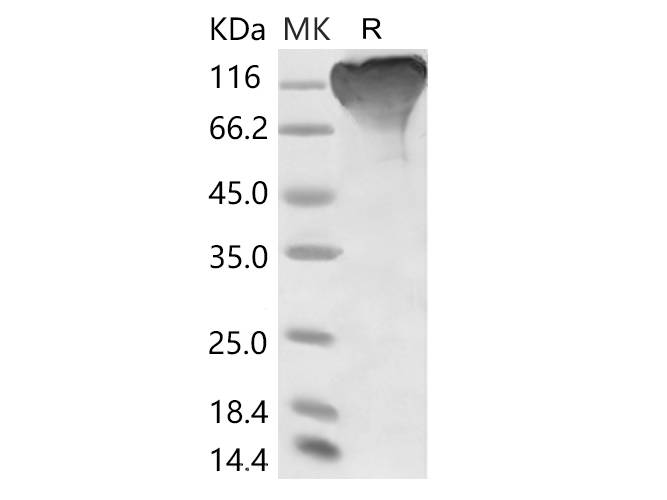 Recombinant 2019-nCoV S1 Protein (mFc Tag)