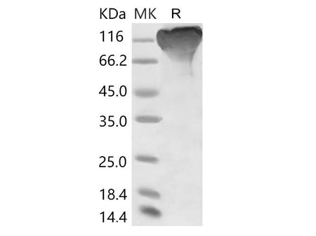 Recombinant 2019-nCoV S1 Protein (mFc Tag)