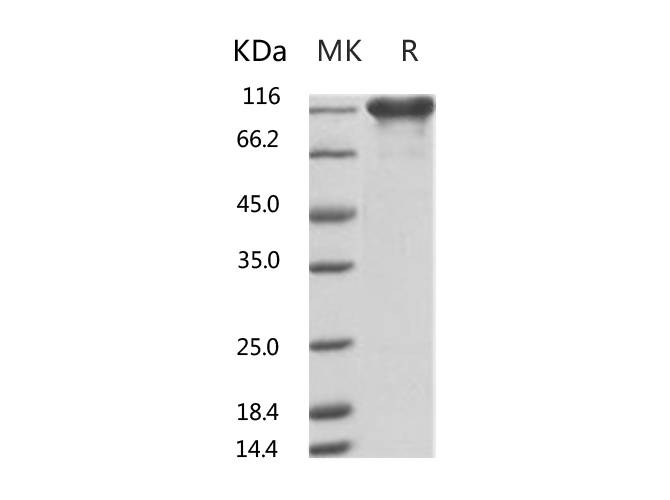 Recombinant Human ACE2 Protein (mFc Tag)