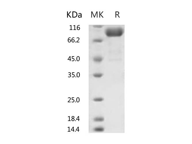 Recombinant Human ACE2 Protein (His Tag) stored at 4-8℃