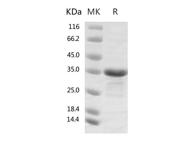 Recombinant 2019-nCoV Papain-like Protease Protein (His Tag)