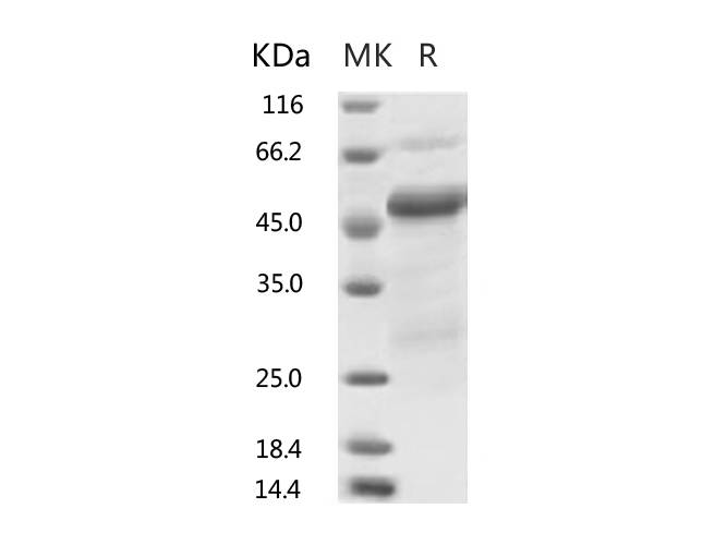 Recombinant 2019-nCoV Nucleocapsid Protein, Biotinylated (His Tag)