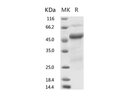 Recombinant 2019-nCoV Nucleocapsid Protein, Biotinylated (His Tag)