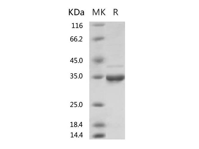 Recombinant 2019-nCoV Methyltransferase / ME Protein (His Tag)