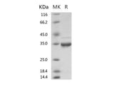 Recombinant 2019-nCoV Methyltransferase / ME Protein (His Tag)