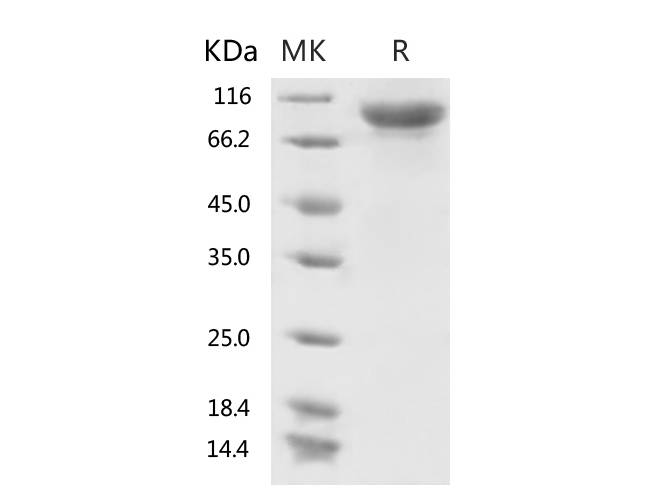 Recombinant 2019-nCoV S1 Protein (His Tag)