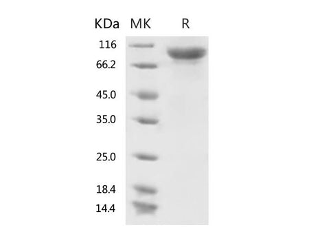 Recombinant 2019-nCoV S1 Protein (His Tag)