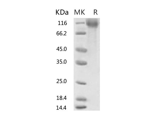 Recombinant 2019-nCoV S1 Protein, Biotinylated (His Tag)