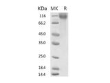 Recombinant 2019-nCoV S1 Protein, Biotinylated (His Tag)