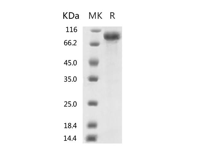 Recombinant 2019-nCoV S2 Protein  (mFc Tag)
