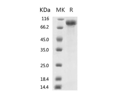 Recombinant 2019-nCoV S2 Protein  (mFc Tag)