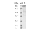 Recombinant 2019-nCoV S2 Protein (ECD, Fc Tag)