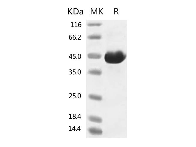 Recombinant 2019-nCoV Spike Protein (RBD, Fc Tag)