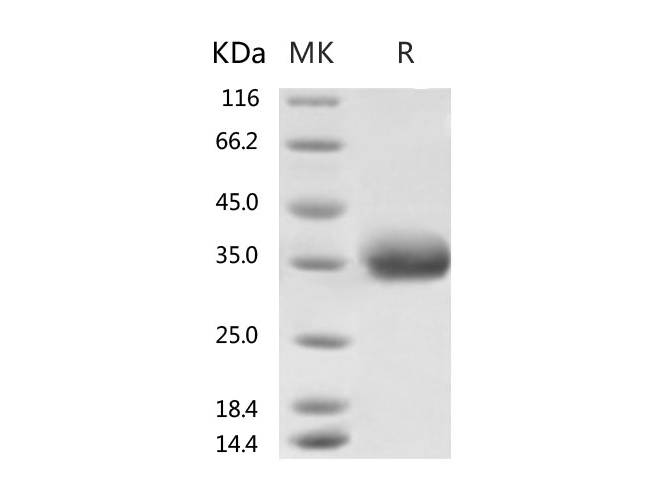Recombinant 2019-nCoV Spike Protein, Biotinylated (RBD, His Tag)