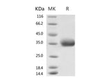 Recombinant 2019-nCoV Spike Protein, Biotinylated (RBD, His Tag)