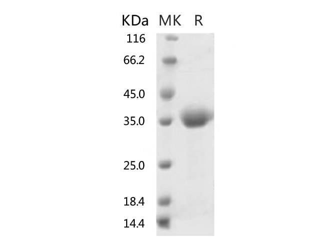Recombinant 2019-nCoV Spike Protein (RBD)