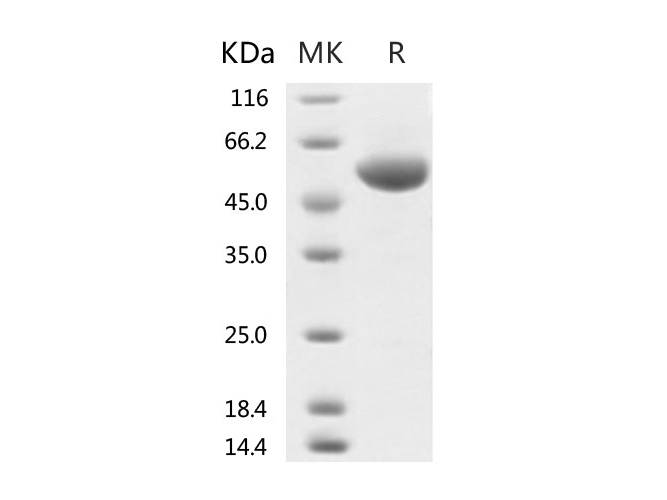 Recombinant 2019-nCoV Spike Protein (RBD, rFc Tag)