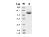 Recombinant 2019-nCoV Spike Protein (RBD, rFc Tag)