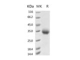 Recombinant 2019-nCoV Spike Protein (RBD, His Tag)(V367F)