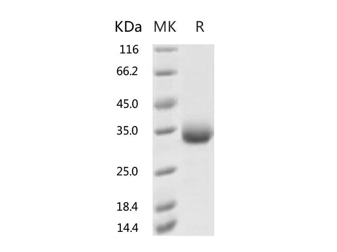 Recombinant 2019-nCoV Spike Protein (RBD, His Tag)(K458R)