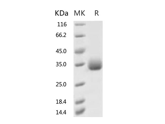 Recombinant 2019-nCoV Spike Protein (RBD, His Tag)(F342L)